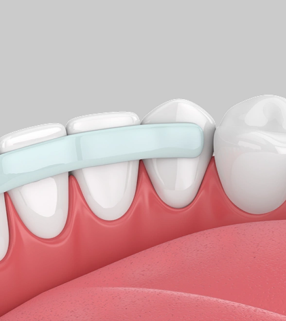 A Simple Way to Improve Your Smile