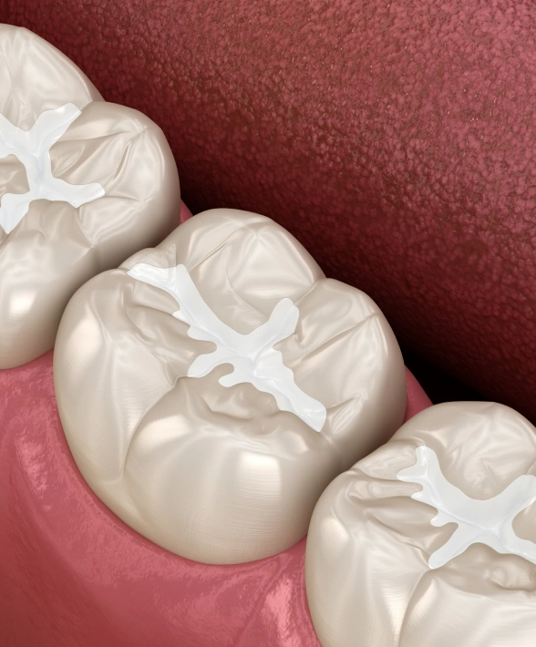 A Simple Way to Prevent Tooth Decay
